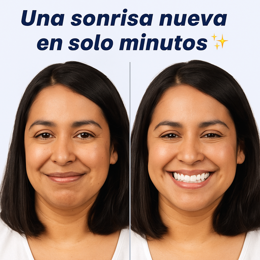 Carillas Plasticas Snapon Smile