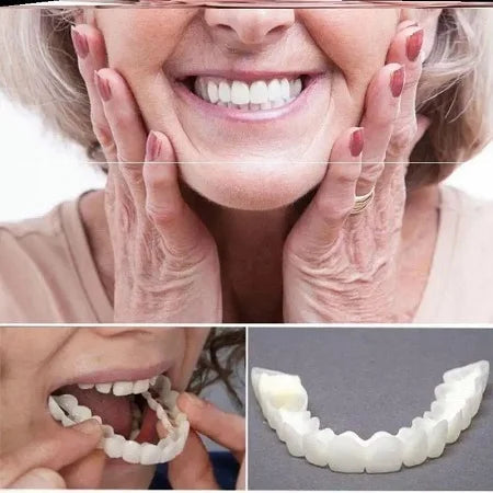 Carillas Plasticas Snapon Smile